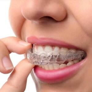 Fix My Smile Dentistry – Toronto photo 2